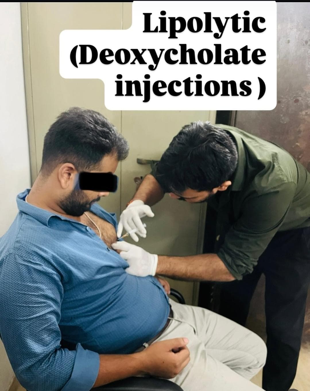 Deoxycholate Injection